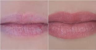 images (48)