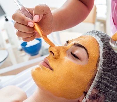 chemical-peel-1